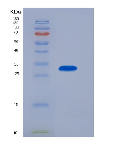 SDS-PAGE analysis of Human IL4I1 (L-Amino-Acid Oxidase) - Recombinant Protein, CAT# BLT-07389P, showing >90% purity under 15% SDS-PAGE (Reduced)Human IL4I1 (L-Amino-Acid Oxidase) - Recombinant Protein