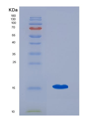 SDS-PAGE analysis of Human ENG (Endoglin) - Recombinant Protein, CAT# BLT-07390P, showing >90% purity under 15% SDS-PAGE (Reduced)Human ENG (Endoglin) - Recombinant Protein