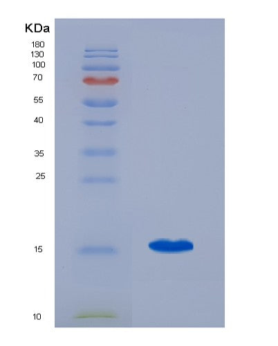 SDS-PAGE analysis of Human ENG (Endoglin) - Recombinant Protein, CATHuman ENG (Endoglin) - Recombinant Protein