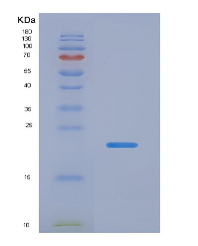 SDS-PAGE analysis of Human EEF1E1 (Eukaryotic Translation Elongation Factor 1 Epsilon-1) - Recombinant Protein, CAT# BLT-00096P, showing >90% purity under 15% SDS-PAGE (Reduced)Human EEF1E1 (Eukaryotic Translation Elongation Factor 1 Epsilon-1) - Recombinant Protein