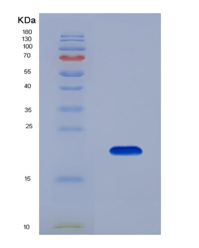 SDS-PAGE analysis of Human BCL2L11 (Bcl-2-Like Protein 11) - Recombinant Protein, CAT# BLT-00303P, showing >95% purity under 15% SDS-PAGE (Reduced)Human BCL2L11 (Bcl-2-Like Protein 11) - Recombinant Protein