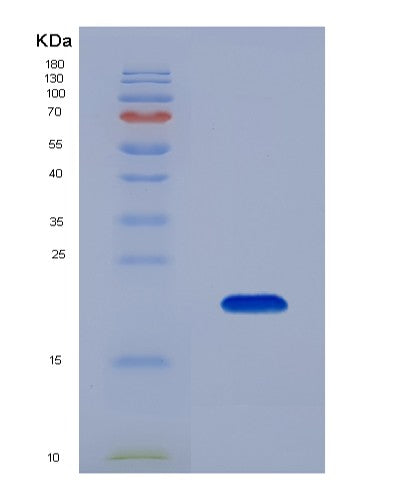 SDS-PAGE analysis of Human BCL2L11 (Bcl-2-Like Protein 11) - Recombinant Protein, CATHuman BCL2L11 (Bcl-2-Like Protein 11) - Recombinant Protein
