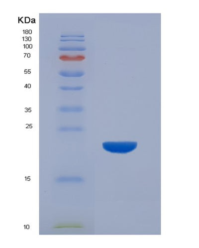 SDS-PAGE analysis of Mouse Cdnf (Cerebral Dopamine Neurotrophic Factor) - Recombinant Protein, CAT# BLT-07394P, showing >90% purity under 15% SDS-PAGE (Reduced)Mouse Cdnf (Cerebral Dopamine Neurotrophic Factor) - Recombinant Protein