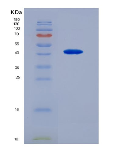 SDS-PAGE analysis of Human HS2ST1 (Heparan Sulfate 2-O-Sulfotransferase 1) - Recombinant Protein, CAT# BLT-07396P, showing >90% purity under 15% SDS-PAGE (Reduced)Human HS2ST1 (Heparan Sulfate 2-O-Sulfotransferase 1) - Recombinant Protein