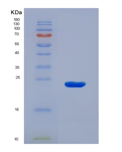 SDS-PAGE analysis of Human APOE (Apolipoprotein E) - Recombinant Protein, CAT# BLT-07397P, showing >90% purity under 15% SDS-PAGE (Reduced)Human APOE (Apolipoprotein E) - Recombinant Protein