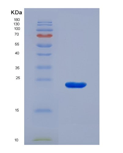 SDS-PAGE analysis of Human APOE (Apolipoprotein E) - Recombinant Protein, CATHuman APOE (Apolipoprotein E) - Recombinant Protein