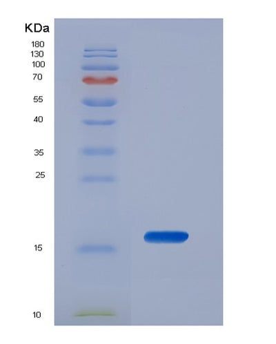 SDS-PAGE analysis of Mouse Vipr1 (Vasoactive Intestinal Polypeptide Receptor 1) - Recombinant Protein, CAT# BLT-07398P, showing >90% purity under 15% SDS-PAGE (Reduced)Mouse Vipr1 (Vasoactive Intestinal Polypeptide Receptor 1) - Recombinant Protein