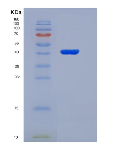 SDS-PAGE analysis of Human PLP1 (Myelin Proteolipid Protein) - Recombinant Protein, CAT# BLT-07399P, showing >90% purity under 15% SDS-PAGE (Reduced)Human PLP1 (Myelin Proteolipid Protein) - Recombinant Protein