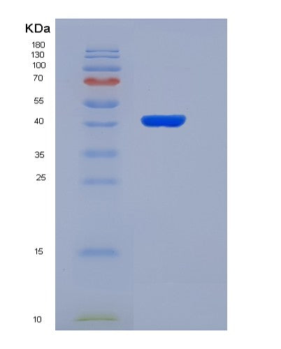 SDS-PAGE analysis of Human PLP1 (Myelin Proteolipid Protein) - Recombinant Protein, CATHuman PLP1 (Myelin Proteolipid Protein) - Recombinant Protein