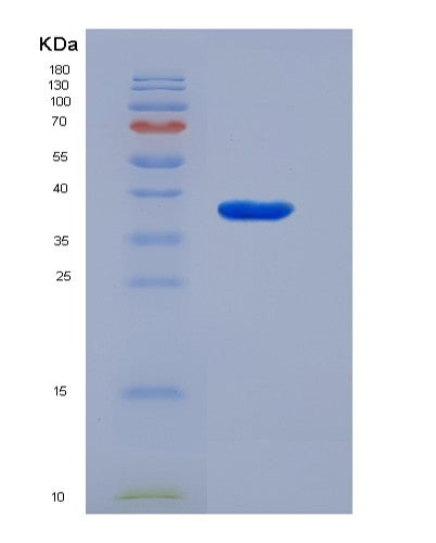 SDS-PAGE analysis of Human SLC25A39 (Mitochondrial Glutathione Transporter Slc25A39) - Recombinant Protein, CATHuman SLC25A39 (Mitochondrial Glutathione Transporter Slc25A39) - Recombinant Protein