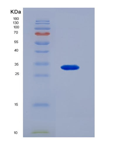 SDS-PAGE analysis of Human XPNPEP2 (Xaa-Pro Aminopeptidase 2) - Recombinant Protein, CAT# BLT-07408P, showing >90% purity under 15% SDS-PAGE (Reduced)Human XPNPEP2 (Xaa-Pro Aminopeptidase 2) - Recombinant Protein