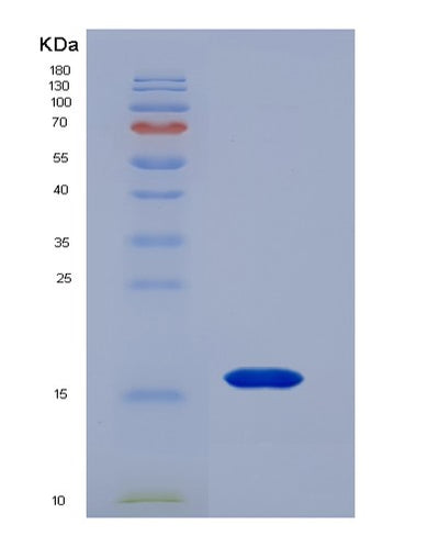 SDS-PAGE analysis of Human CXCL13 (C-X-C Motif Chemokine 13) - Recombinant Protein, CAT# BLT-00774P, showing >85% purity under 15% SDS-PAGE (Reduced)Human CXCL13 (C-X-C Motif Chemokine 13) - Recombinant Protein