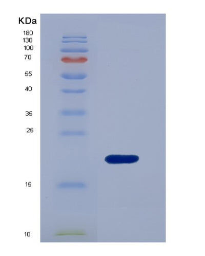 SDS-PAGE analysis of Mouse Lgals7 (Galectin-7) - Recombinant Protein, CAT# BLT-01710P, showing >85% purity under 15% SDS-PAGE (Reduced)Mouse Lgals7 (Galectin-7) - Recombinant Protein