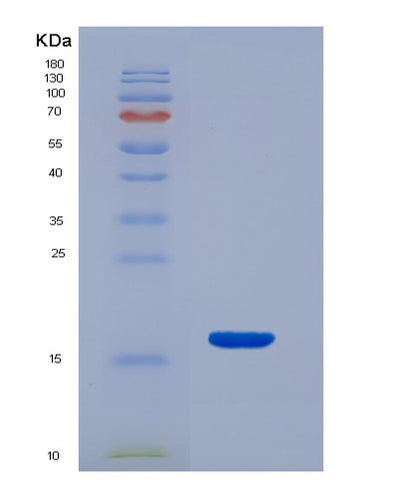 SDS-PAGE analysis of Mouse Snca (Alpha-Synuclein) - Recombinant Protein, CAT# BLT-03568P, showing >95% purity under 15% SDS-PAGE (Reduced)Mouse Snca (Alpha-Synuclein) - Recombinant Protein