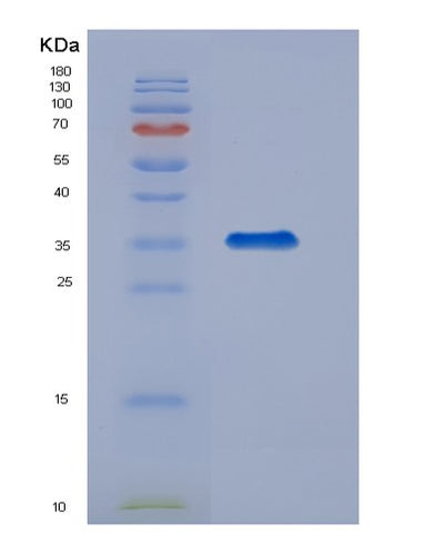 SDS-PAGE analysis of Mouse Tfpi (Tissue Factor Pathway Inhibitor) - Recombinant Protein, CAT# BLT-07409P, showing >90% purity under 15% SDS-PAGE (Reduced)Mouse Tfpi (Tissue Factor Pathway Inhibitor) - Recombinant Protein