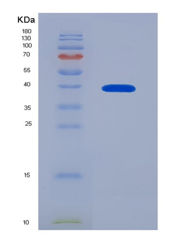 SDS-PAGE analysis of Human AKR1B10 (Aldo-Keto Reductase Family 1 Member B10) - Recombinant Protein, CAT# BLT-07411P, showing >90% purity under 15% SDS-PAGE (Reduced)Human AKR1B10 (Aldo-Keto Reductase Family 1 Member B10) - Recombinant Protein