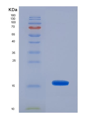 SDS-PAGE analysis of Mouse Cd70 (Cd70 Antigen) - Recombinant Protein, CAT# BLT-07412P, showing >90% purity under 15% SDS-PAGE (Reduced)Mouse Cd70 (Cd70 Antigen) - Recombinant Protein