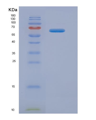 SDS-PAGE analysis of Human LAMB2 (Laminin Subunit Beta-2) - Recombinant Protein, CAT# BLT-07413P, showing >90% purity under 15% SDS-PAGE (Reduced)Human LAMB2 (Laminin Subunit Beta-2) - Recombinant Protein