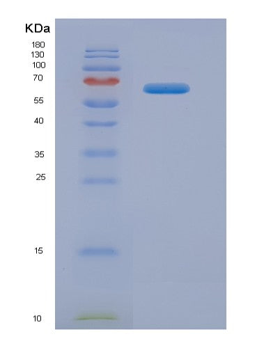 SDS-PAGE analysis of Human LAMB2 (Laminin Subunit Beta-2) - Recombinant Protein, CATHuman LAMB2 (Laminin Subunit Beta-2) - Recombinant Protein