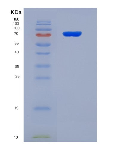 SDS-PAGE analysis of Human GSN (Gelsolin) - Recombinant Protein, CATHuman GSN (Gelsolin) - Recombinant Protein