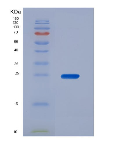 SDS-PAGE analysis of Human BAX (Apoptosis Regulator Bax) - Recombinant Protein, CAT# BLT-07419P, showing >90% purity under 15% SDS-PAGE (Reduced)Human BAX (Apoptosis Regulator Bax) - Recombinant Protein