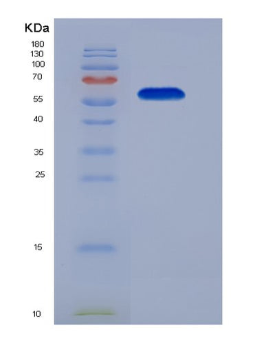 SDS-PAGE analysis of Mouse IQ Motif Containing GTPase Activating 1 (IQGAP1) - Recombinant Protein, CAT# BLT-07420P, showing >90% purity under 15% SDS-PAGE (Reduced)Mouse IQ Motif Containing GTPase Activating 1 (IQGAP1) - Recombinant Protein