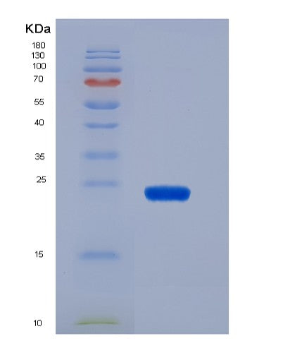 SDS-PAGE analysis of Human IL23A (Interleukin-23 Subunit Alpha) - Recombinant Protein, CATHuman IL23A (Interleukin-23 Subunit Alpha) - Recombinant Protein