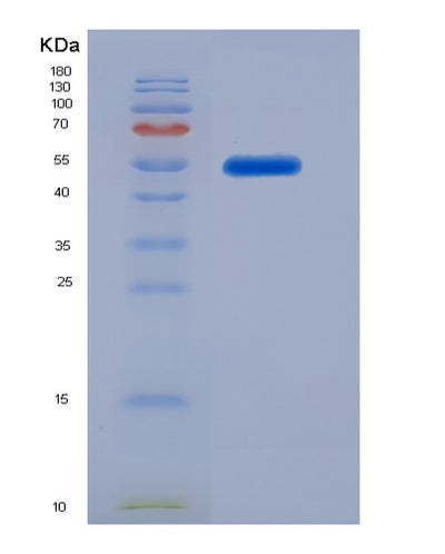 SDS-PAGE analysis of Human GAS7 (Growth Arrest-Specific Protein 7) - Recombinant Protein, CAT# BLT-01159P, showing >85% purity under 15% SDS-PAGE (Reduced)Human GAS7 (Growth Arrest-Specific Protein 7) - Recombinant Protein