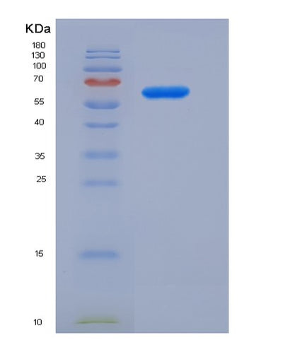 SDS-PAGE analysis of Human WNT2B (Protein Wnt-2B) - Recombinant Protein, CAT# BLT-07428P, showing >90% purity under 15% SDS-PAGE (Reduced)Human WNT2B (Protein Wnt-2B) - Recombinant Protein