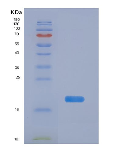 SDS-PAGE analysis of Human PFDN1 (Prefoldin Subunit 1) - Recombinant Protein, CAT# BLT-02221P, showing >90% purity under 15% SDS-PAGE (Reduced)Human PFDN1 (Prefoldin Subunit 1) - Recombinant Protein