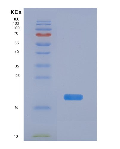 SDS-PAGE analysis of Human PFDN1 (Prefoldin Subunit 1) - Recombinant Protein, CATHuman PFDN1 (Prefoldin Subunit 1) - Recombinant Protein