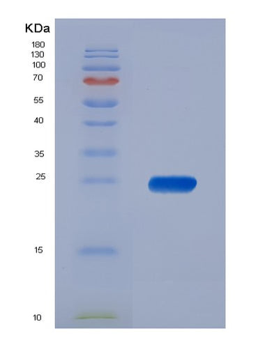 SDS-PAGE analysis of Human PPP1R11 (E3 Ubiquitin-Protein Ligase Ppp1R11) - Recombinant Protein, CAT# BLT-02354P, showing >95% purity under 15% SDS-PAGE (Reduced)Human PPP1R11 (E3 Ubiquitin-Protein Ligase Ppp1R11) - Recombinant Protein