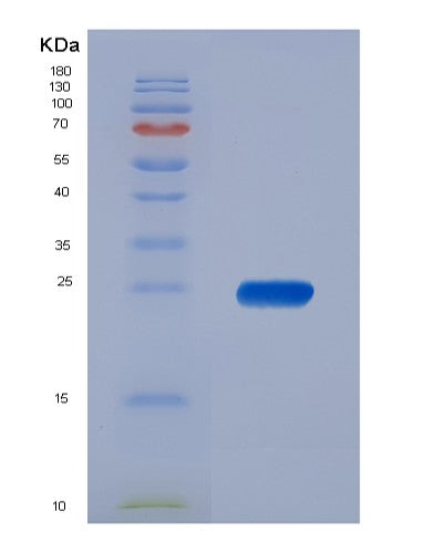 SDS-PAGE analysis of Human PPP1R11 (E3 Ubiquitin-Protein Ligase Ppp1R11) - Recombinant Protein, CATHuman PPP1R11 (E3 Ubiquitin-Protein Ligase Ppp1R11) - Recombinant Protein