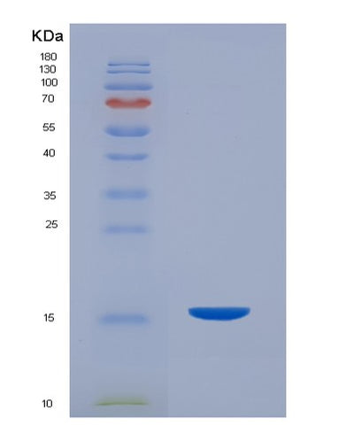 SDS-PAGE analysis of Mouse Pigr (Polymeric Immunoglobulin Receptor) - Recombinant Protein, CAT# BLT-07434P, showing >90% purity under 15% SDS-PAGE (Reduced)Mouse Pigr (Polymeric Immunoglobulin Receptor) - Recombinant Protein