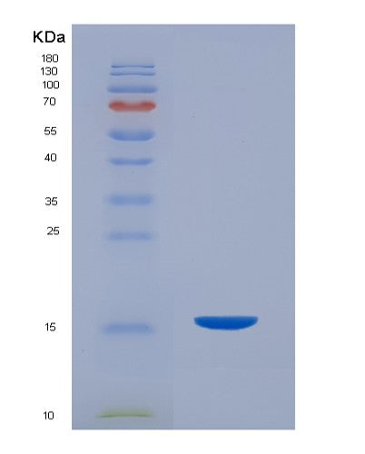 SDS-PAGE analysis of Mouse Pigr (Polymeric Immunoglobulin Receptor) - Recombinant Protein, CATMouse Pigr (Polymeric Immunoglobulin Receptor) - Recombinant Protein