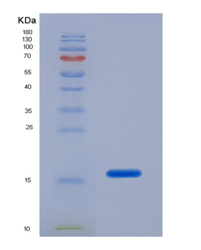 SDS-PAGE analysis of Human POSTN (Periostin) - Recombinant Protein, CAT# BLT-07437P, showing >90% purity under 15% SDS-PAGE (Reduced)Human POSTN (Periostin) - Recombinant Protein