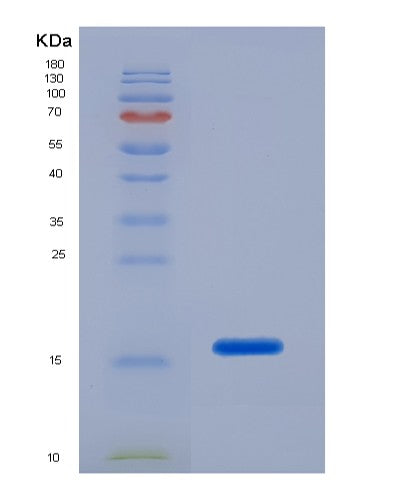 SDS-PAGE analysis of Human POSTN (Periostin) - Recombinant Protein, CATHuman POSTN (Periostin) - Recombinant Protein