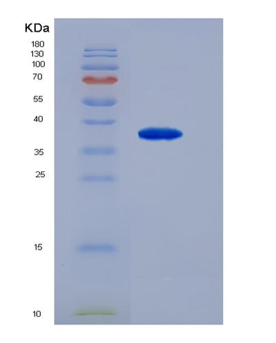 SDS-PAGE analysis of Mouse Sik2 (Serine/Threonine-Protein Kinase Sik2) - Recombinant Protein, CAT# BLT-07438P, showing >90% purity under 15% SDS-PAGE (Reduced)Mouse Sik2 (Serine/Threonine-Protein Kinase Sik2) - Recombinant Protein