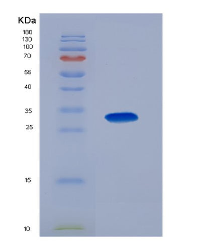 SDS-PAGE analysis of Mouse Col1a1 (Collagen Alpha-1(I) Chain) - Recombinant Protein, CAT# BLT-07440P, showing >90% purity under 15% SDS-PAGE (Reduced)Mouse Col1a1 (Collagen Alpha-1(I) Chain) - Recombinant Protein