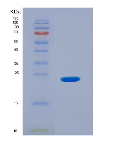 SDS-PAGE analysis of Human FCGR3B (Low Affinity Immunoglobulin Gamma Fc Region Receptor Iii-B) - Recombinant Protein, CAT# BLT-03791P, showing >95% purity under 15% SDS-PAGE (Reduced)Human FCGR3B (Low Affinity Immunoglobulin Gamma Fc Region Receptor Iii-B) - Recombinant Protein