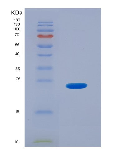 SDS-PAGE analysis of Human FCGR3B (Low Affinity Immunoglobulin Gamma Fc Region Receptor Iii-B) - Recombinant Protein, CATHuman FCGR3B (Low Affinity Immunoglobulin Gamma Fc Region Receptor Iii-B) - Recombinant Protein