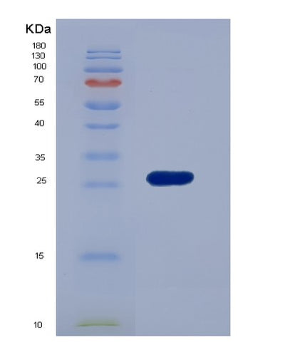 SDS-PAGE analysis of Human LILRB3 (Leukocyte Immunoglobulin-Like Receptor Subfamily B Member 3) - Recombinant Protein, CAT# BLT-07441P, showing >90% purity under 15% SDS-PAGE (Reduced)Human LILRB3 (Leukocyte Immunoglobulin-Like Receptor Subfamily B Member 3) - Recombinant Protein