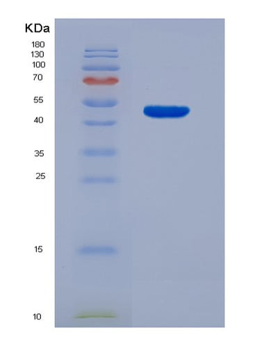 SDS-PAGE analysis of Human ICOSLG (Icos Ligand) - Recombinant Protein, CAT# BLT-06886P, showing >95% purity under 15% SDS-PAGE (Reduced)Human ICOSLG (Icos Ligand) - Recombinant Protein