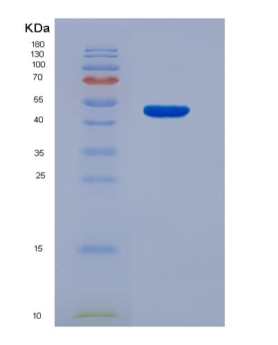 SDS-PAGE analysis of Human ICOSLG (Icos Ligand) - Recombinant Protein, CATHuman ICOSLG (Icos Ligand) - Recombinant Protein