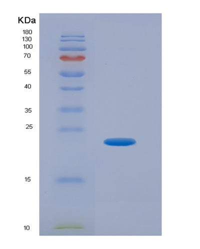 SDS-PAGE analysis of Human GADD45B (Growth Arrest And Dna Damage-Inducible Protein Gadd45 Beta) - Recombinant Protein, CAT# BLT-04909P, showing >90% purity under 15% SDS-PAGE (Reduced)Human GADD45B (Growth Arrest And Dna Damage-Inducible Protein Gadd45 Beta) - Recombinant Protein