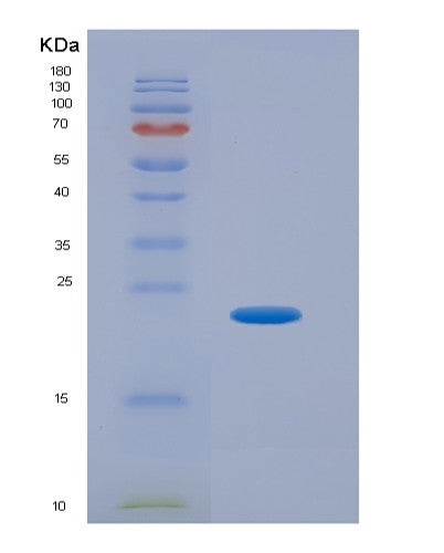 SDS-PAGE analysis of Human GADD45B (Growth Arrest And Dna Damage-Inducible Protein Gadd45 Beta) - Recombinant Protein, CATHuman GADD45B (Growth Arrest And Dna Damage-Inducible Protein Gadd45 Beta) - Recombinant Protein