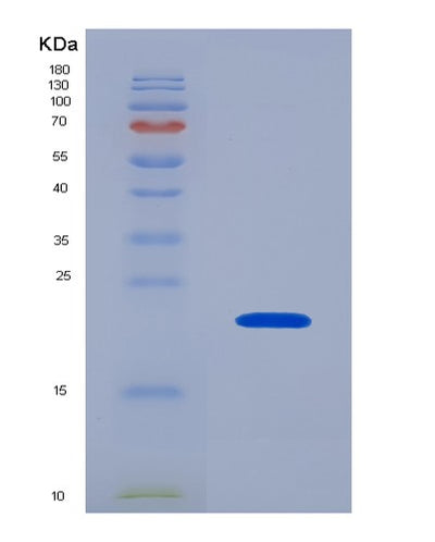 SDS-PAGE analysis of Human PROS1 (Vitamin K-Dependent Protein S) - Recombinant Protein, CAT# BLT-07443P, showing >90% purity under 15% SDS-PAGE (Reduced)Human PROS1 (Vitamin K-Dependent Protein S) - Recombinant Protein