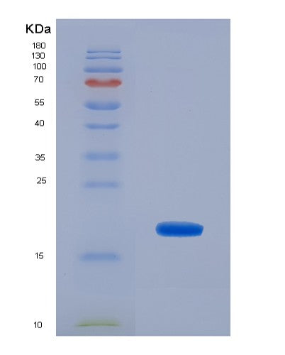SDS-PAGE analysis of Human TBCA (Tubulin-Specific Chaperone A) - Recombinant Protein, CATHuman TBCA (Tubulin-Specific Chaperone A) - Recombinant Protein