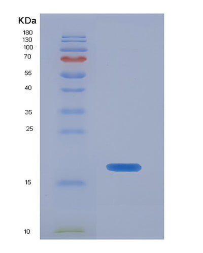 SDS-PAGE analysis of Human ECRG4 (Augurin) - Recombinant Protein, CAT# BLT-07446P, showing >90% purity under 15% SDS-PAGE (Reduced)Human ECRG4 (Augurin) - Recombinant Protein