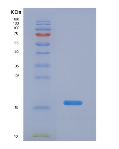 SDS-PAGE analysis of Human PPARG (Peroxisome Proliferator-Activated Receptor Gamma) - Recombinant Protein, CAT# BLT-07449P, showing >90% purity under 15% SDS-PAGE (Reduced)Human PPARG (Peroxisome Proliferator-Activated Receptor Gamma) - Recombinant Protein
